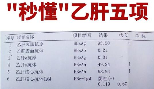 如何看懂乙肝五项检查报告?