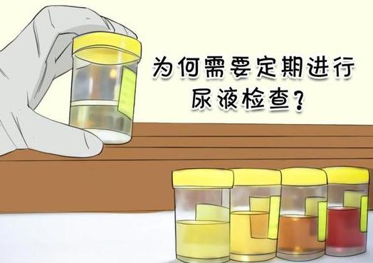入职体检尿蛋白弱阳性？别急，这里有解决办法！