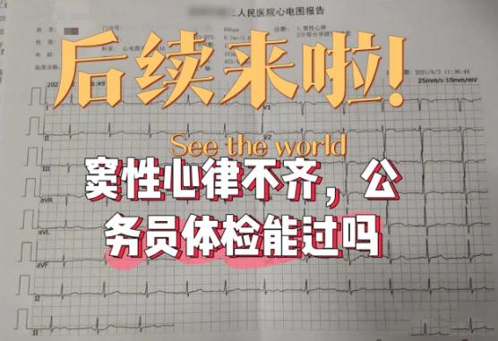 公务员体检心电图哪些情况会“不合格”？