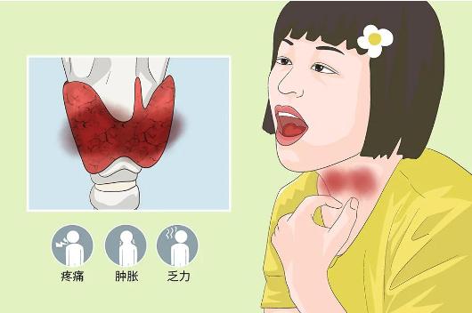 桥本甲状腺炎考公体检想要通过，这些攻略你必须知道！