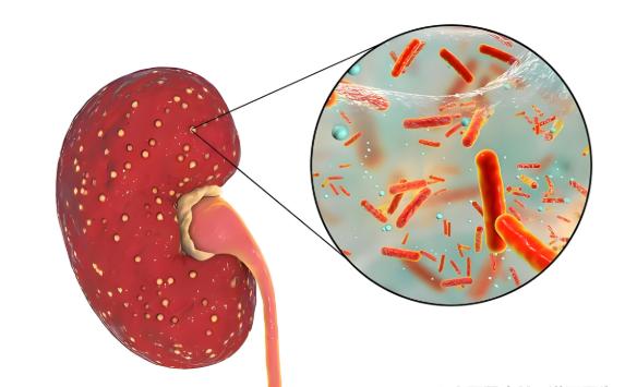 公务员体检对肾炎筛查：为何如此严格？