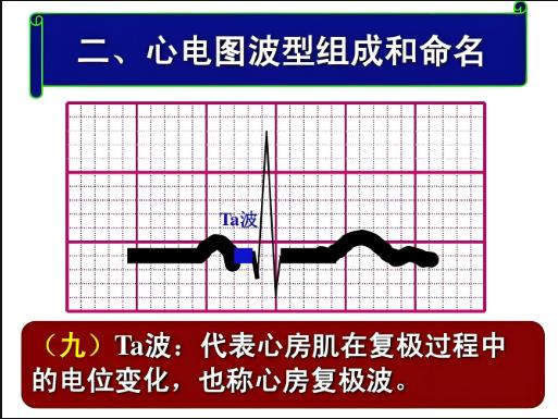 公务员体检心电图T波改变，体检合不合格看完这篇就懂了！