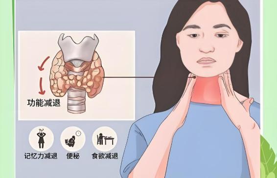 桥本甲状腺疾病能顺利通过公务员体检吗？为什么无法通过？