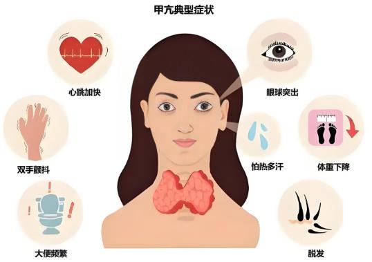 事业单位体检会查甲功吗？查甲状腺哪些问题？