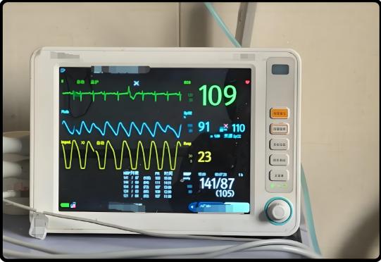 心率过快，公务员体检能通过吗？揭秘公务员体检不合格的应对策略