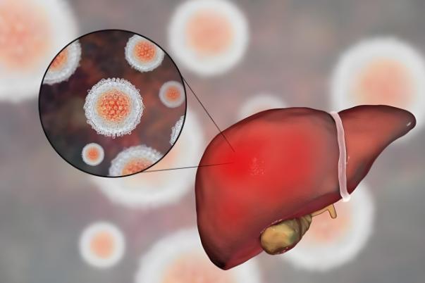 入职体检肝功能异常，体检不合格，无法上班，该如何应对处理？