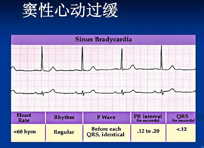 深圳入户体检心电图有哪些异常情况？体检不合格怎么办？
