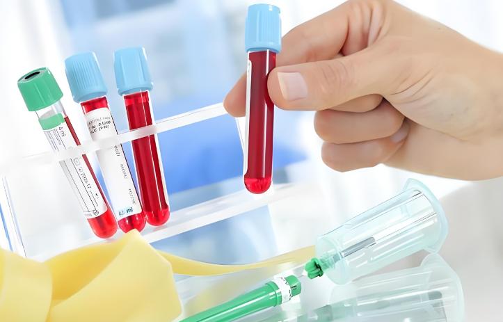 国家电网入职体检肌酐偏高，会影响体检结果吗？